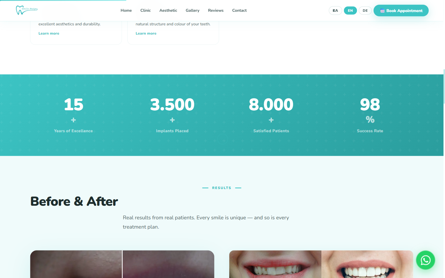 Smile Design results section — a mineral-green stat panel (15+ years / 3,500 implants / 8,000 patients / 98% success) sits above the 'Before & After' real-cases gallery introduction.